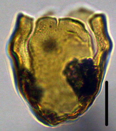 Hystrichosphaeridium tubiferum 4 Hcftub cac 27X2021350112a.jpg